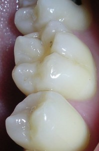 camera+intra+oral+odontologica+dentista+recife+pe+brasil__B49F13_3